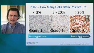 Neuroendocrine Neoplasms Thor Halfdanarson [upl. by Boaten]