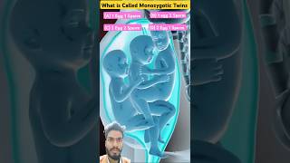 Monozygotic Twins is CalledTwins Babybaby twinmoments shortvideo [upl. by Seraphim4]