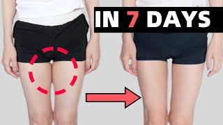 1 WEEK Thigh Gap Challenge  10 Min INNER THIGH Workout Knee Friendly No Equipment [upl. by Nagiem]