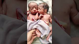 Adorable Twin Newborn Babies AfterBirth [upl. by Aicekal]