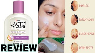 Lacto Calamine face Lotion Review How To Use lacto Calamine Lotion lactocalaminelotion [upl. by Adnomar]