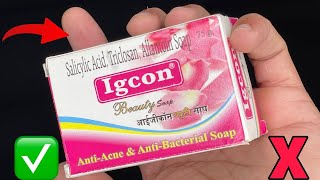 Igcon Cream Side Effects kaise thik kare  Fairness in 3 night [upl. by Ahseined813]