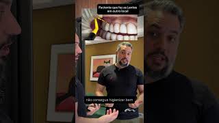 Dr Marcelo Magalhães  Facetas em Resina Composta  Lentes em Porcelana  Implantes dentários [upl. by Assilam]