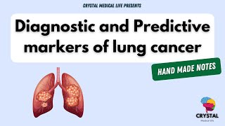 Diagnostic and predictive biomarkers of lung carcinoma [upl. by Sawtelle]