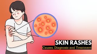 Skin Rash Causes Signs and Symptoms Diagnosis and Treatment [upl. by Adine]