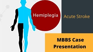 MBBS case presentation  Hemiplegia [upl. by Ennaeirb]