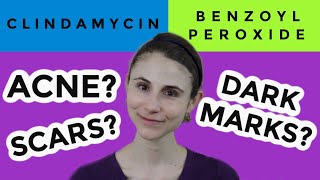 Clindamycin versus benzoyl peroxide for acne Dr Dray [upl. by Nathaniel338]