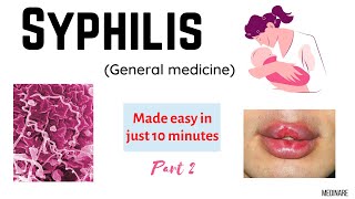 Syphilis Part  2  Made easy in 10 minutes  Medinare [upl. by Rosamund]