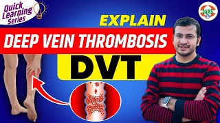 Deep Vein Thrombosis DVT Causes Symptoms amp Treatment  Quick Learning Series by Siddharth Sir [upl. by Jilli575]