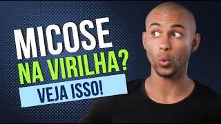 Micose virilha  Por que surge Como tratar Por Luiz Gameiro dermatologista [upl. by Stets800]