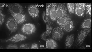 Dengue Virus Infection Induces Mitochondrial Elongation [upl. by Pittel]