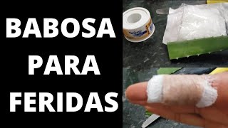 Babosa para feridas [upl. by Ahsille]