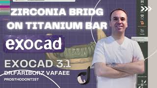 How to design zirconia bridge on titanuom bar in exocad31 [upl. by Clauddetta]