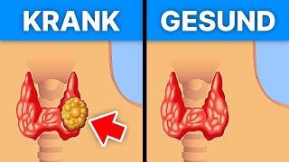 3 Lebensmittel die deine SchilddrüsenFunktion verbessern [upl. by Anirehs]