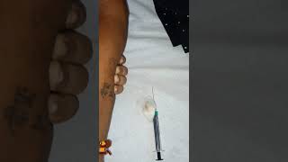 subcutaneous injection video skin test video vlog xylocaine sensitivity kaise kare full procedure [upl. by Iznek]