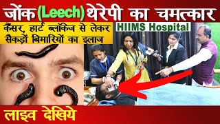 Leech therapy in ayurveda आयुर्वेद की लीच थेरपी Acharya Manish ji  HIIMS Hospital  National Khabar [upl. by Stempien]