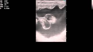 Ultrasound of a 40 day equine pregnancy [upl. by Norrahc120]