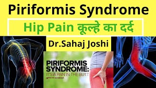 Piriformis Syndrome Homeopathic Medicines for Piriformis Syndrome [upl. by Greeson]