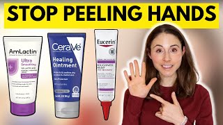 How to STOP SKIN PEELING ON THE HANDS amp FEET 🤔 Dermatologist DrDrayzday [upl. by Egnalos]