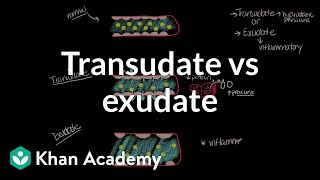 Transudate vs exudate  Respiratory system diseases  NCLEXRN  Khan Academy [upl. by Ahsaela]