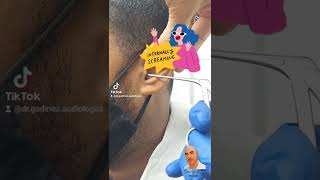 Ear cleaning removal of Qtip or swab [upl. by Oiratno]