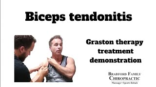 Bicep tendinitis treatment Demonstration of Graston therapy [upl. by Annyahs]