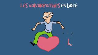 Les valvulopathies un enjeu de santé publique [upl. by Rise]