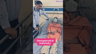 osteoporosis and deformity osteoporosis osteoarthritis doctor [upl. by Einnob]