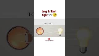 Short and Long Sight  myopia and hyperopia [upl. by Eihpos]