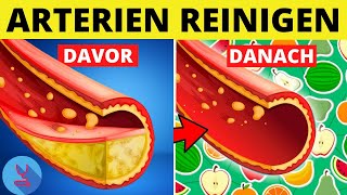 Diese Top 4 Lebensmittel reinigen deine Arterien und helfen bei der Vorbeugung von Arteriosklerose [upl. by Itin]