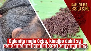 Dalagita mula Cebu kinalbo dahil sa sandamakmak na kuto sa kanyang ulo  Kapuso Mo Jessica Soho [upl. by Nessa948]