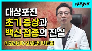 대상포진 치료 후에도 극심한 고통이 계속 된다면  초기증상 재발방지 예방접종 효과 [upl. by Yelyab]