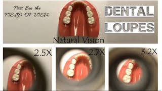 DentalLoupes Dental LoupesComparison of 25x 27x and 32x magnificationadmetec loupes [upl. by Kentigerma]