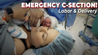 NATURAL Delivery turned EMERGENCY CSection  Birth Vlog 2021 [upl. by Fini]