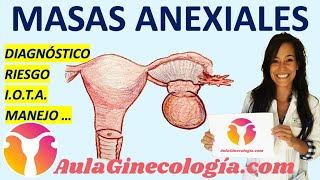 MASAS ANEXIALES DIAGNÓSTICO ECOGRAFÍA CÁLCULO DE RIESGO MANEJO  Ginecología y Obstetricia [upl. by Atilrak]