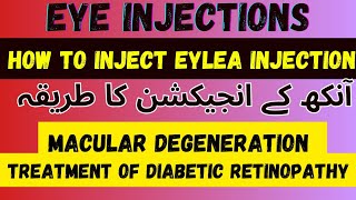 Intravitreal Eylea injection 💉  Intravitreal AntiVegf Injection  Dr Faisal Anwar [upl. by Ahsatam815]