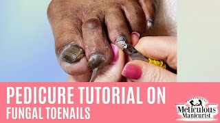 How to Pedicure on Thick Dark Toenails with Nail Fungus [upl. by Nilrac]