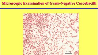 سكشن عملى Gramnegative coccobacilli [upl. by Gobert741]