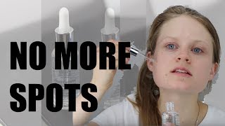 Kiehls Clearly Corrective Dark Spot Solution Review [upl. by Tavey]