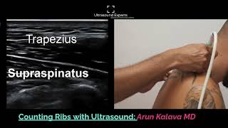 Counting Ribs On Ultrasound [upl. by Blasius]