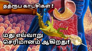 Digestion of alcohol is not like other food in Tamil  How Alcohol Changes Your Body  Hangover [upl. by Inafets]