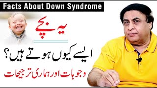 Down Syndrome Trisomy 21  Causes Symptoms amp Diagnosis  Dr Khalid Jamil [upl. by Acinor]