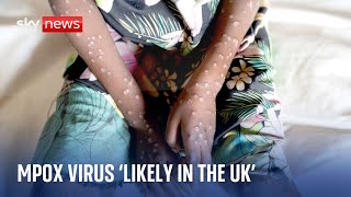 Experts warn deadly mpox virus is quite likely in the UK [upl. by Adnarahs379]