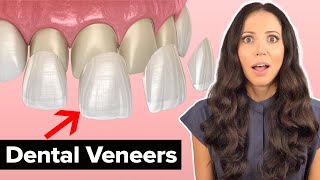 Dental Veneers Procedure Explained [upl. by Enirhtak]