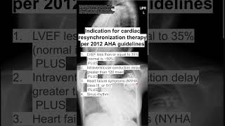 Indication for cardiac resynchronization therapy per 2012 AHA guidelines [upl. by Lehte291]