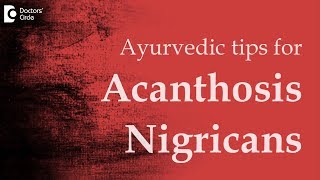 Tips in ayurveda for Acanthosis Nigricans  Dr Mini Nair [upl. by Hajidahk]