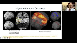 How Dizziness Can Be Caused By Migraine [upl. by Weiler915]