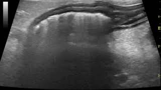 Ultrasonography of acute canine pancreatitis with associated colitis [upl. by Nnyledam867]