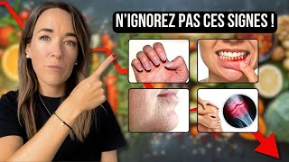 CES 11 SIGNES montrent que votre CORPS MANQUE DE NUTRIMENTS ESSENTIELS naturopathie [upl. by Ericka110]