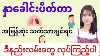 နှာခေါင်းပိတ်ခြင်းကို အမြန်ဆုံး သက်သာစေနိုင်မယ့် အိမ်တွင်း နည်းလမ်းများ [upl. by Riebling]